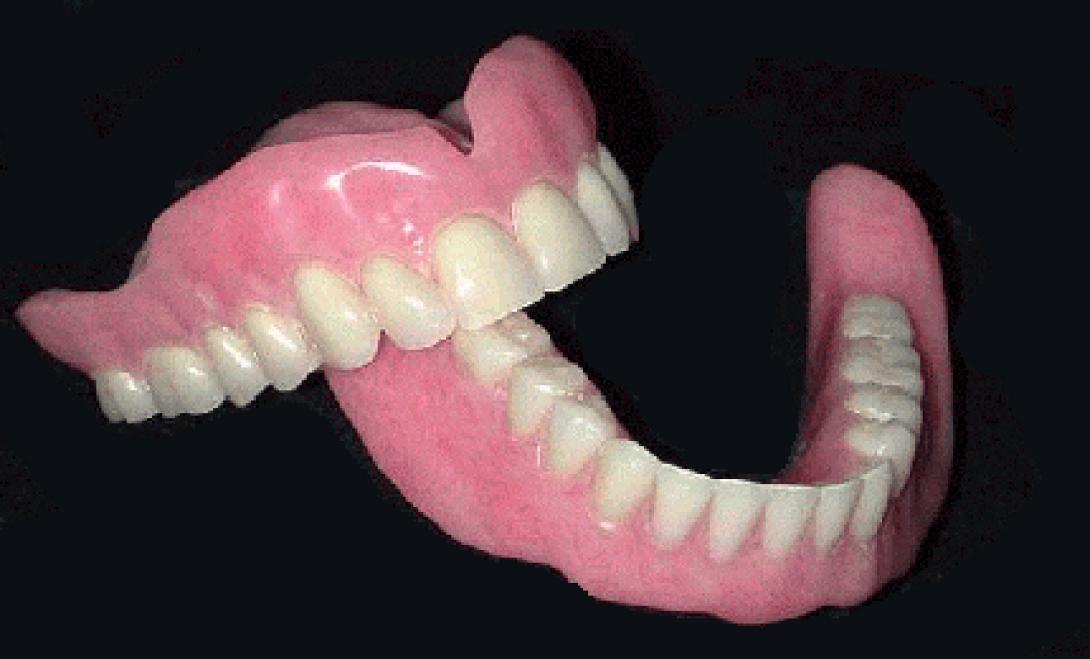 Βρέθηκε το αρχαιότερο ψεύτικο δόντι στην Ευρώπη