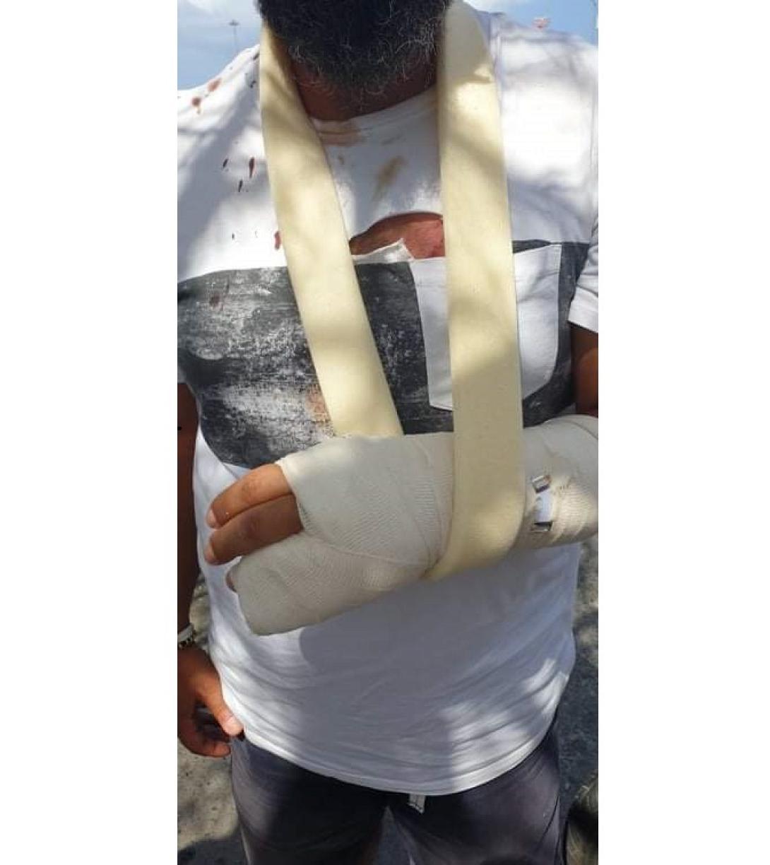 εμφανή τα τραύματα του οδηγού