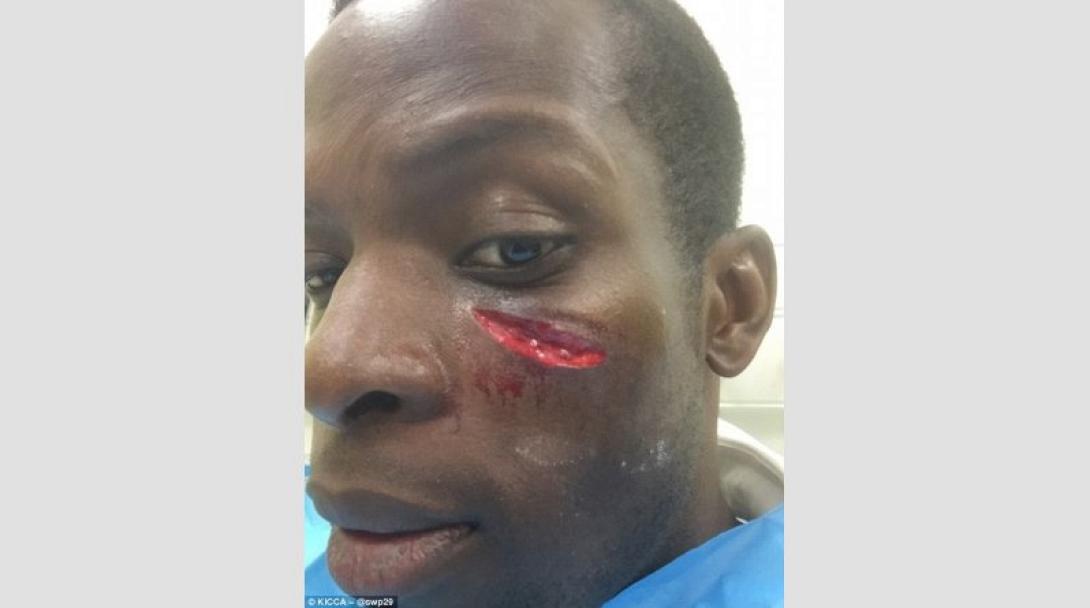 Σοκάρει η πληγή του Ονουόχα!