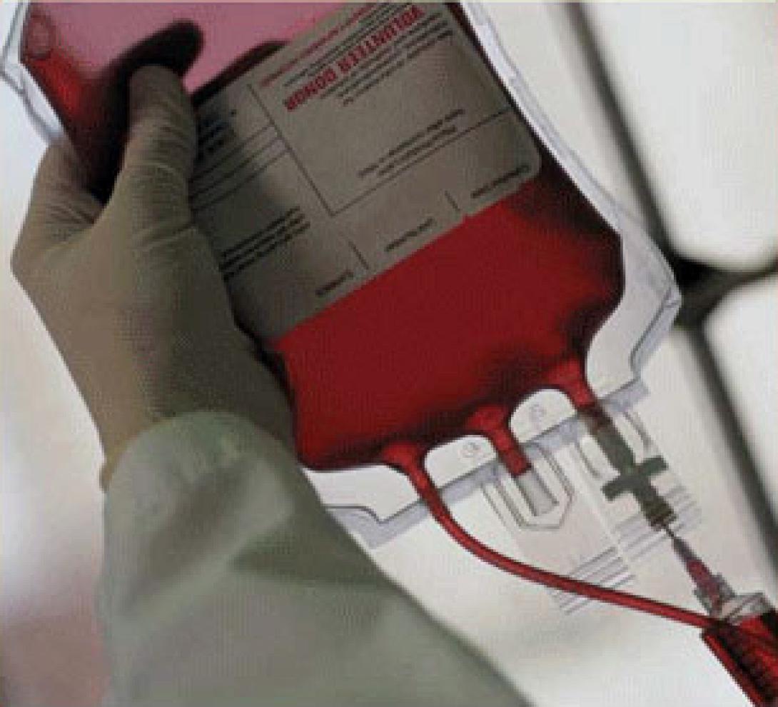 Άμεση ανάγκη από αιμοπετάλια για φοιτητή στα Χανιά 