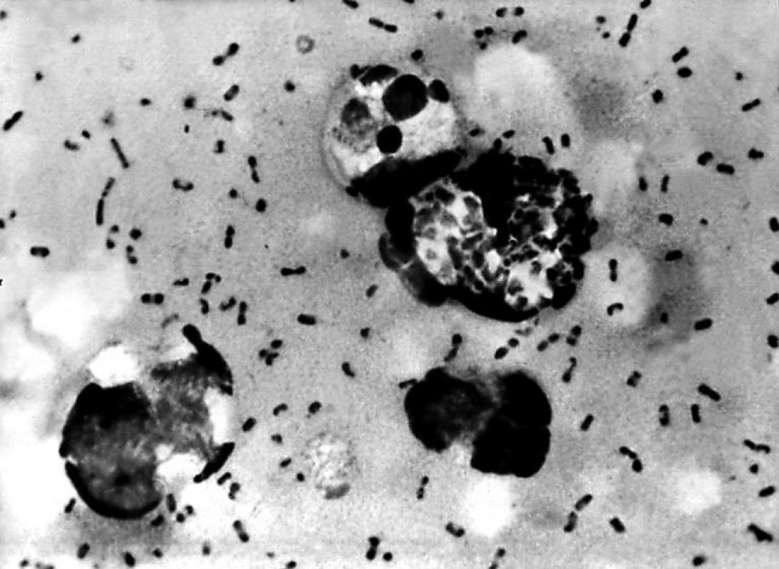 plague-768x561.jpg