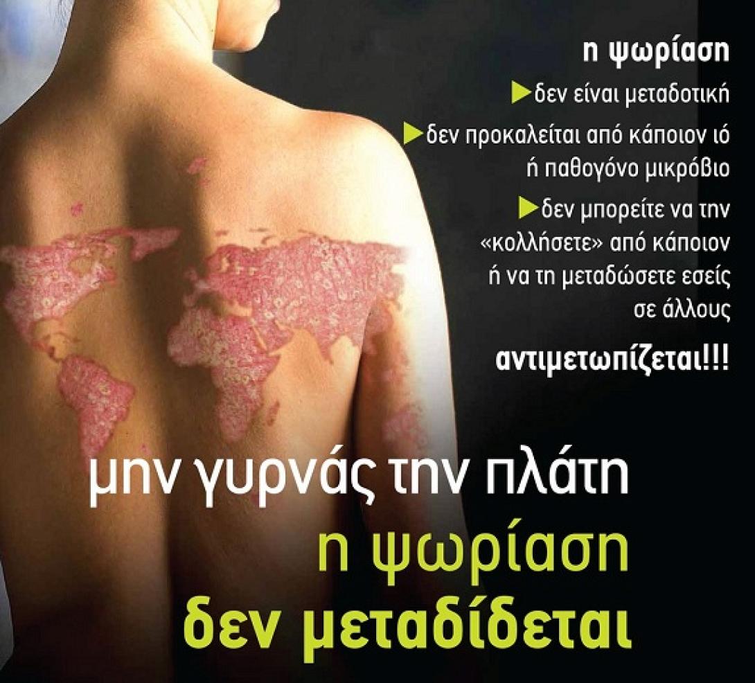 psoriasi.jpg