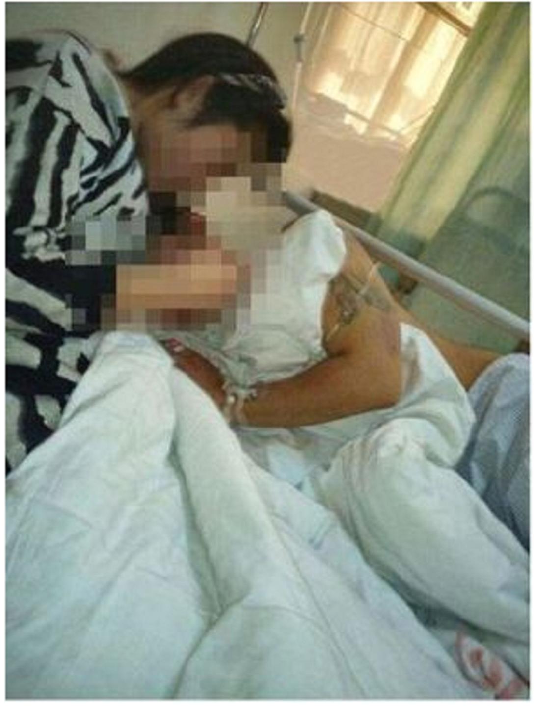 Κίνα: Γυναίκα έκοψε δυο φορές το πέος του άντρα της