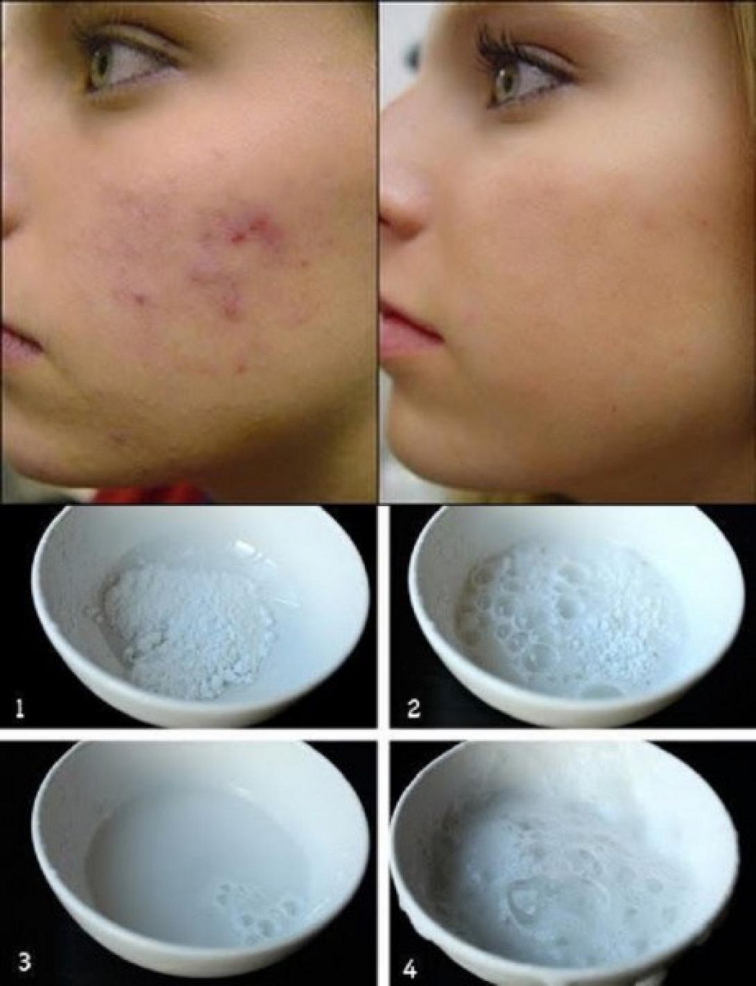 spitiki_syntagi_gia_katharo_kai_leio_derma.jpg