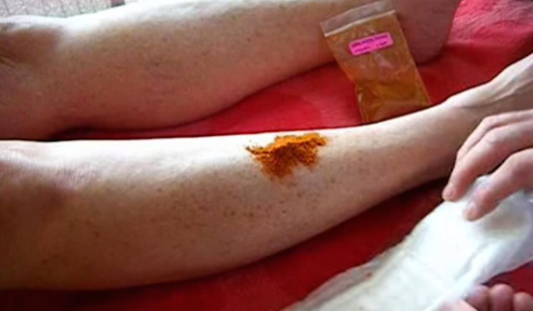 stamatiste_tin_aimorragia_se_10_deyterolepta_me_paprika.png