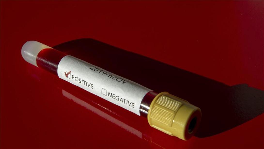 κορωνοϊός-τεστ