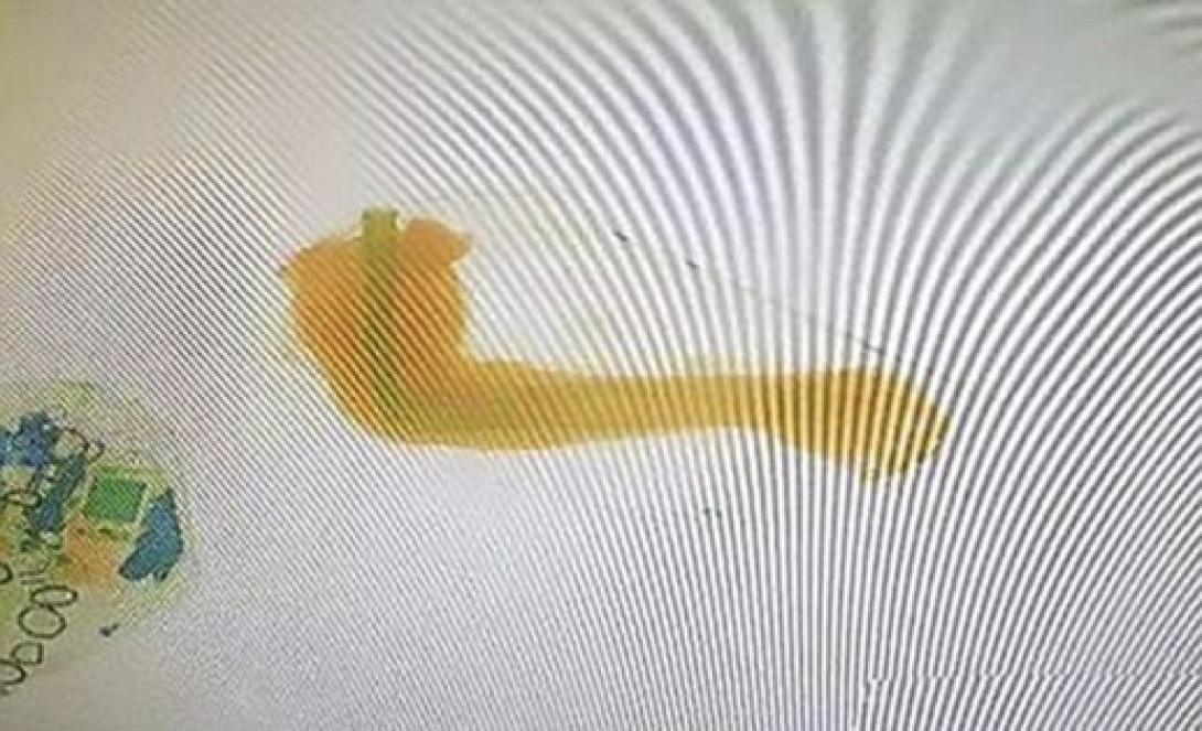 χέρια