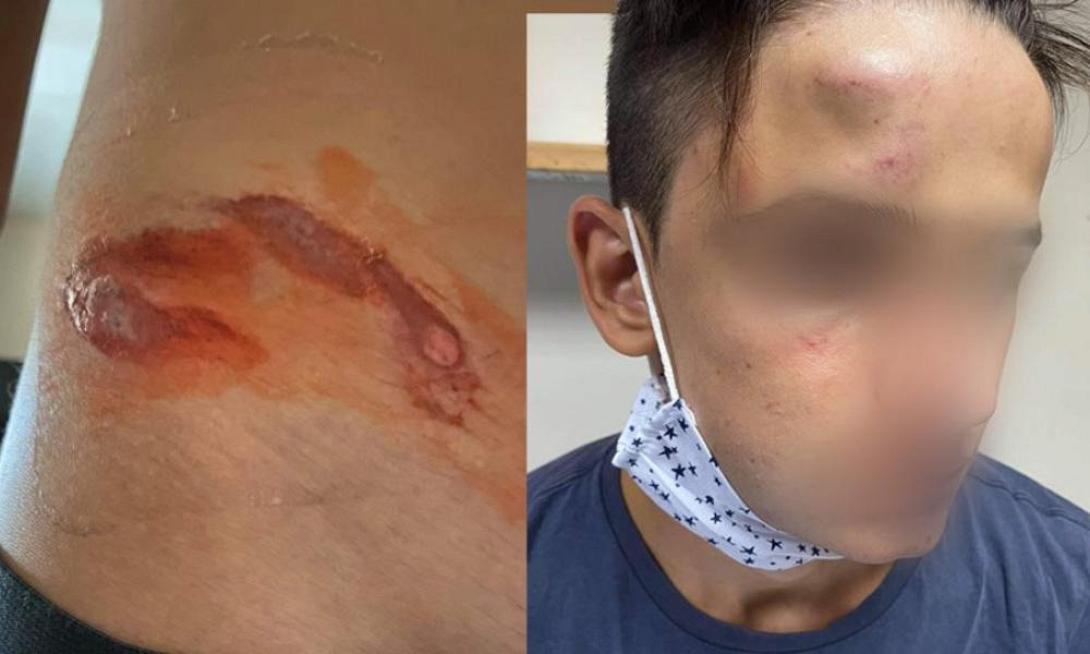 17χρονος ξυλοδαρμός